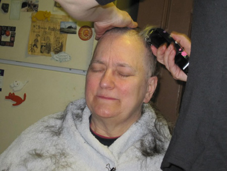 After Starting Chemotherapy, The Wife Loses Her Waist-Length Hair, March 2011